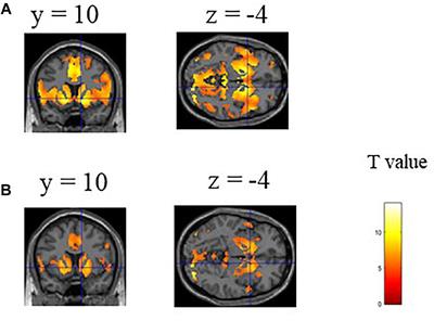 Predicting Ventral Striatal Activation During Reward Anticipation From Functional Connectivity at Rest